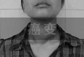 �����ʸߴ�50%