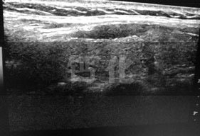 �ƻ��󰩱��ʷ�9��